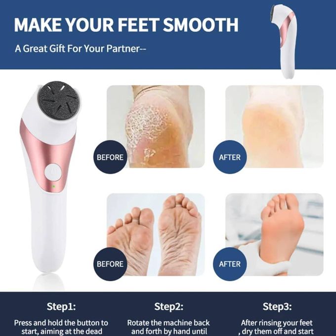 Ponceuse a Pied Electrique-rape à pieds peau morte